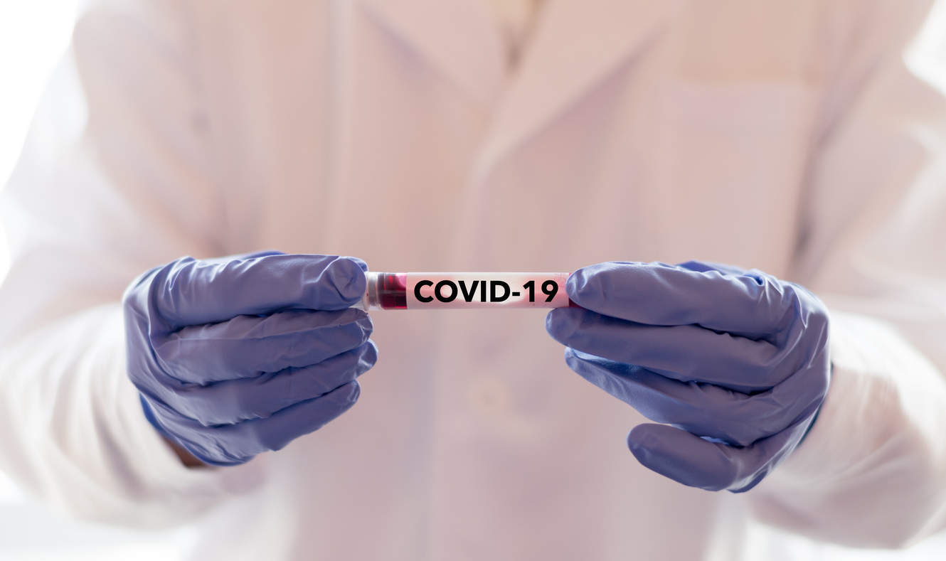 What does COVID-19 mean for road safety?
